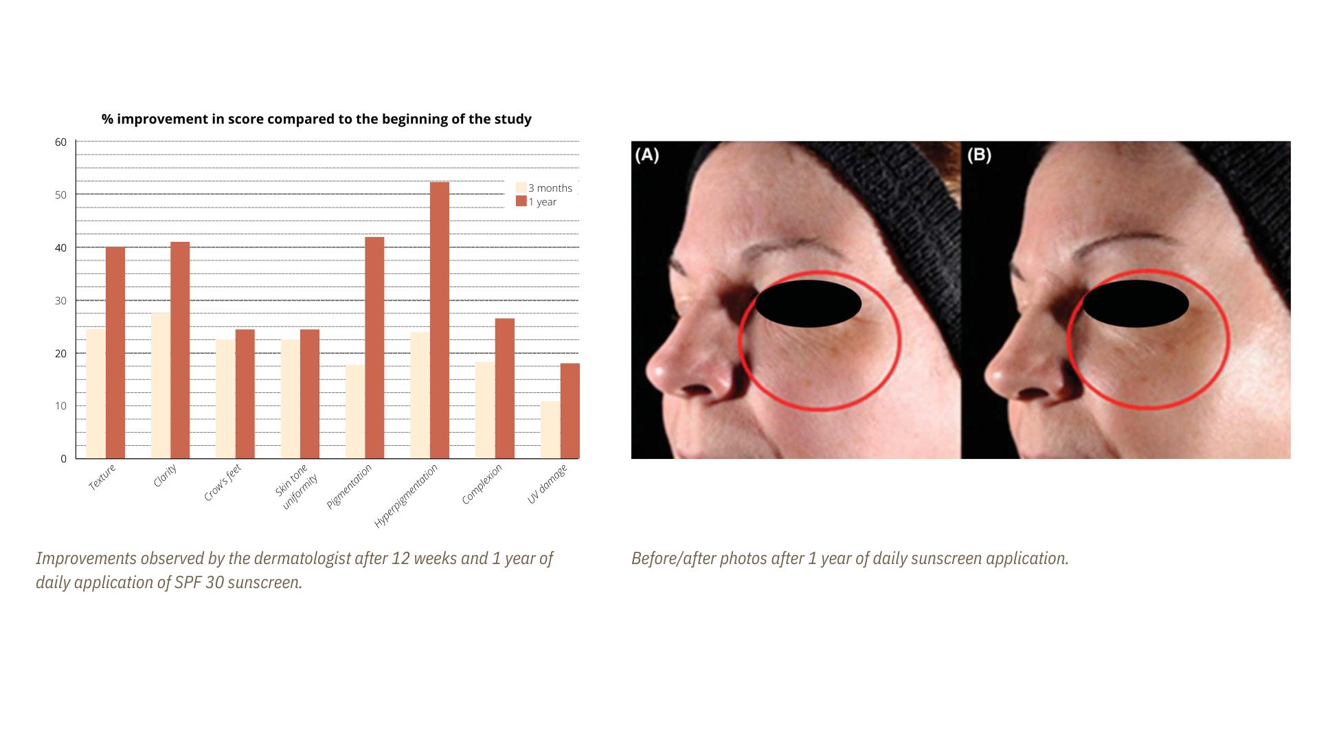 The Anti-Aging Benefits of Sunscreen Proven by Science: Results from a Clinical Study